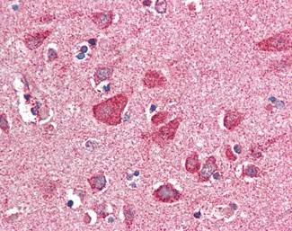 PITPNM3 Antibody in Immunohistochemistry (Paraffin) (IHC (P))