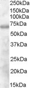DEF6 Antibody in Western Blot (WB)