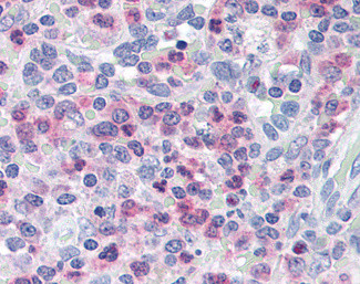 Munc13-4 Antibody in Immunohistochemistry (Paraffin) (IHC (P))