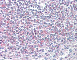 CD2BP2 Antibody in Immunohistochemistry (Paraffin) (IHC (P))