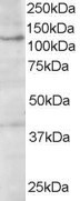 HPS3 Antibody in Western Blot (WB)