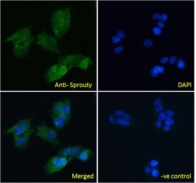 SPRY1 Antibody in Immunocytochemistry (ICC/IF)