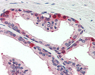 JIK Antibody in Immunohistochemistry (Paraffin) (IHC (P))