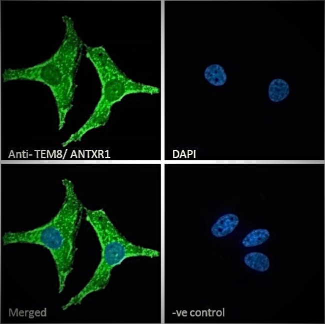 TEM8 Antibody in Immunocytochemistry (ICC/IF)