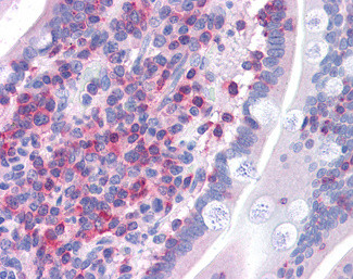 FNBP1 Antibody in Immunohistochemistry (Paraffin) (IHC (P))