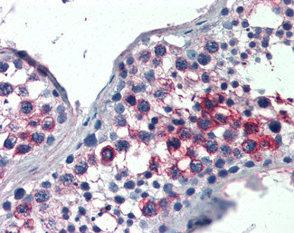 FHL1 Antibody in Immunohistochemistry (Paraffin) (IHC (P))
