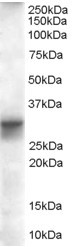 FHL1 Isoform B Antibody in Western Blot (WB)