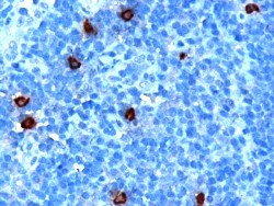 DOK5 Antibody in Immunohistochemistry (Paraffin) (IHC (P))