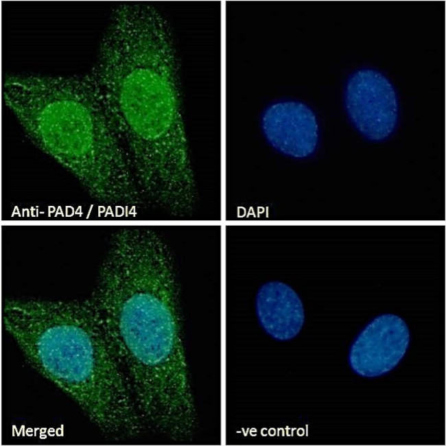 PADI4 Antibody in Immunocytochemistry (ICC/IF)