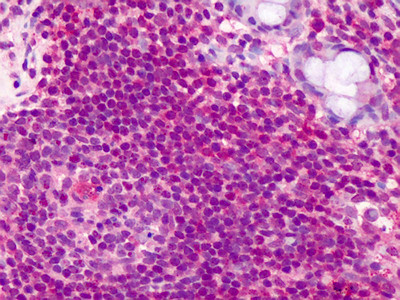 Ymer Antibody in Immunohistochemistry (Paraffin) (IHC (P))