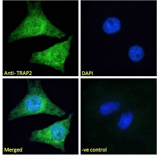 PSMD2 Antibody in Immunocytochemistry (ICC/IF)