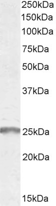 SYNGR2 Antibody in Western Blot (WB)