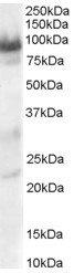 TRAK1 Antibody in Western Blot (WB)