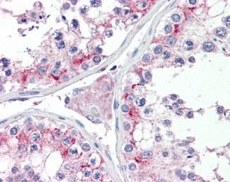 ZDHHC17 Antibody in Immunohistochemistry (Paraffin) (IHC (P))
