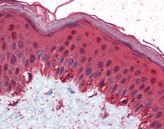 AP2 gamma Antibody in Immunohistochemistry (Paraffin) (IHC (P))