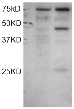 DYX1C1 Antibody in Western Blot (WB)