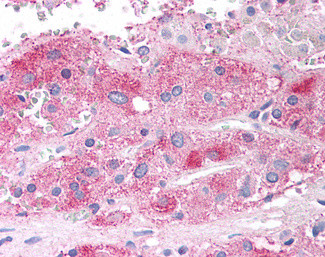 SEMA3E Antibody in Immunohistochemistry (Paraffin) (IHC (P))