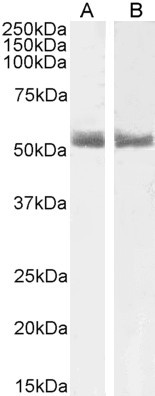 RARA Antibody in Western Blot (WB)