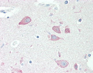 Neuroserpin Antibody in Immunohistochemistry (Paraffin) (IHC (P))