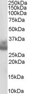 Cathepsin F Antibody in Western Blot (WB)