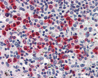 NGAL Antibody in Immunohistochemistry (Paraffin) (IHC (P))