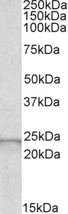 GPX2 Antibody in Western Blot (WB)