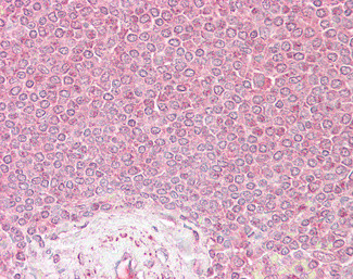 VPS45 Antibody in Immunohistochemistry (Paraffin) (IHC (P))