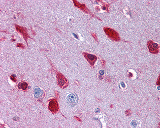 RAE1 Antibody in Immunohistochemistry (Paraffin) (IHC (P))