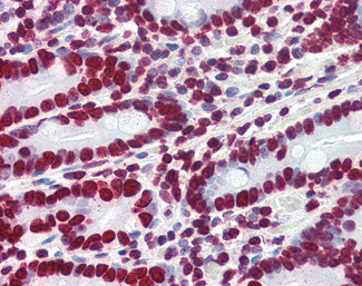 HMGA1 Antibody in Immunohistochemistry (Paraffin) (IHC (P))