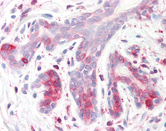 ERLIN2 Antibody in Immunohistochemistry (Paraffin) (IHC (P))