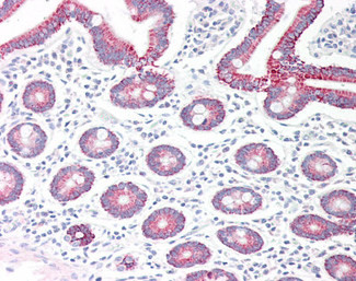 MAOA Antibody in Immunohistochemistry (Paraffin) (IHC (P))