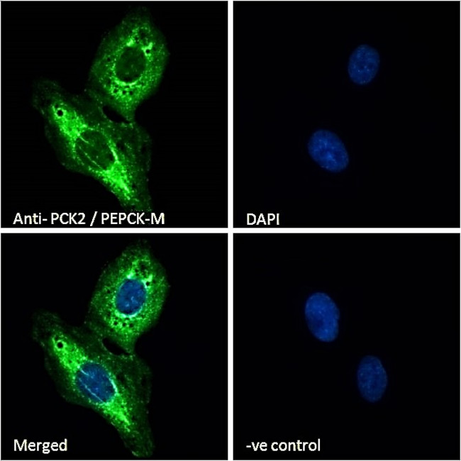PCK2 Antibody in Immunocytochemistry (ICC/IF)