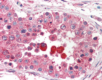 PCID1 Antibody in Immunohistochemistry (Paraffin) (IHC (P))