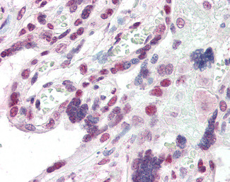 HP1 beta Antibody in Immunohistochemistry (Paraffin) (IHC (P))
