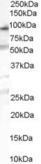 OSBPL10 Antibody in Western Blot (WB)