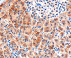 FZD8 Antibody in Immunohistochemistry (Paraffin) (IHC (P))