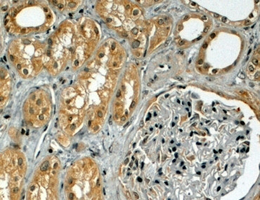 TRIM5 alpha Antibody in Immunohistochemistry (Paraffin) (IHC (P))
