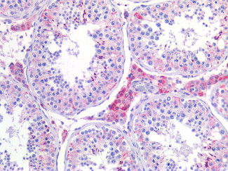 SCD Antibody in Immunohistochemistry (Paraffin) (IHC (P))