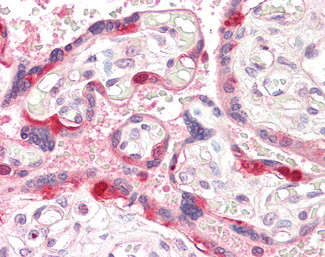 GEF5 Antibody in Immunohistochemistry (Paraffin) (IHC (P))