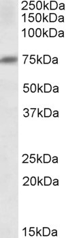 DCP1A Antibody in Western Blot (WB)