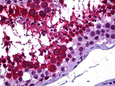 GALR3 Antibody in Immunohistochemistry (Paraffin) (IHC (P))