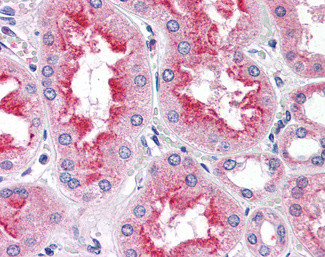 SMAD9 Antibody in Immunohistochemistry (Paraffin) (IHC (P))