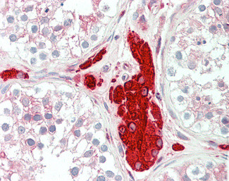 PGRMC1 Antibody in Immunohistochemistry (Paraffin) (IHC (P))