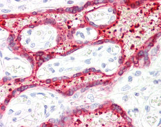 HSD3B1 Antibody in Immunohistochemistry (Paraffin) (IHC (P))