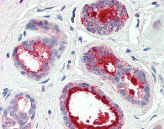 GCDFP-15 Antibody in Immunohistochemistry (Paraffin) (IHC (P))