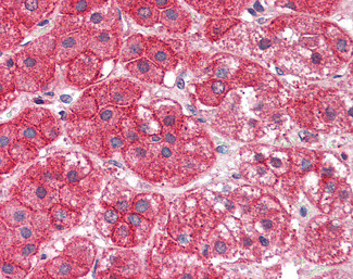 EXOC7 Antibody in Immunohistochemistry (Paraffin) (IHC (P))