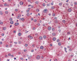 AKR1C4 Antibody in Immunohistochemistry (Paraffin) (IHC (P))