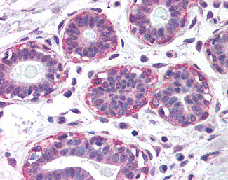 NET1 Antibody in Immunohistochemistry (Paraffin) (IHC (P))