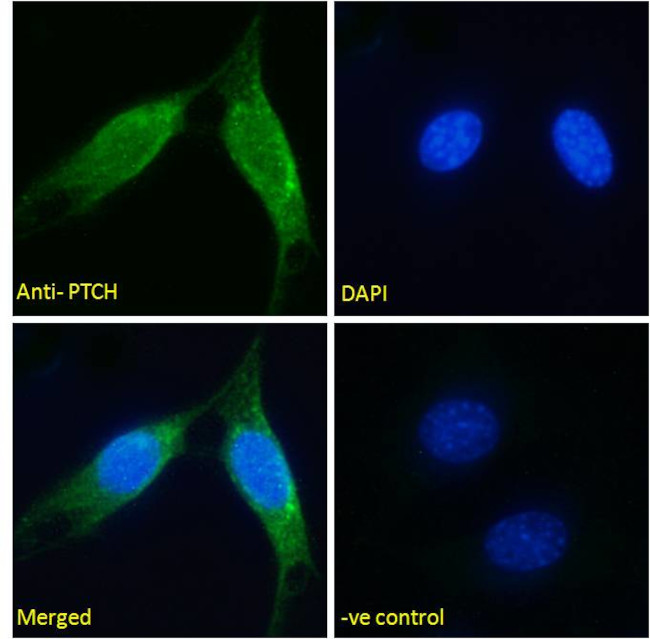 PTCH Antibody in Immunocytochemistry (ICC/IF)