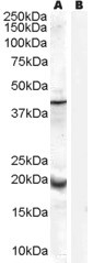 GPX7 Antibody in Western Blot (WB)